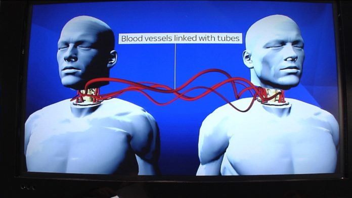 Chinese Patient Will Receive World’s First Head Transplant Surgery