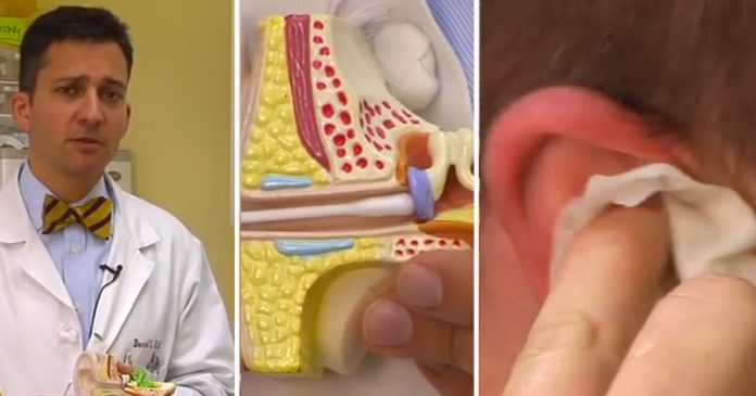 Never Use Cotton Swab To Clean Ears – This Is Why