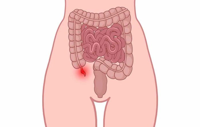 5 Warning Signs Of Appendix That It Might Burst