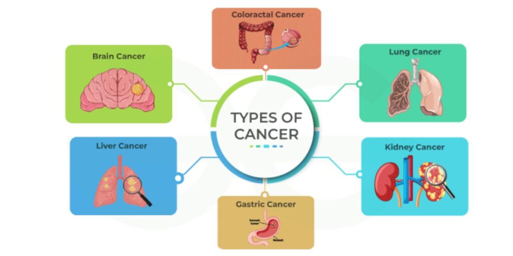 Types of Cancer